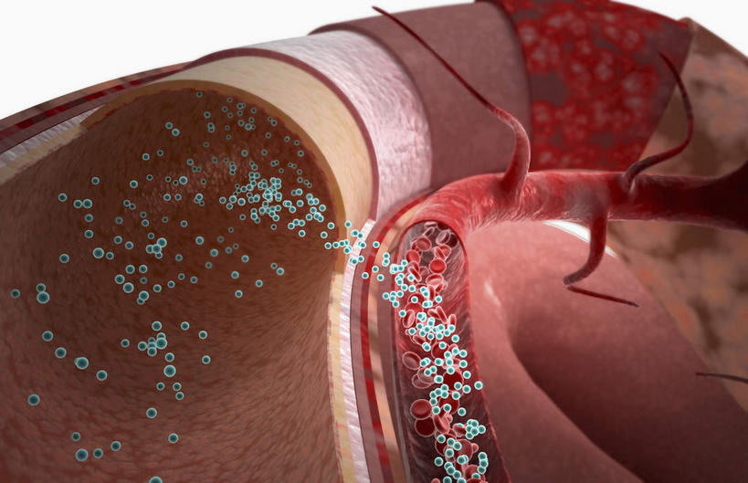 内脏,肠,动脉,静脉,十二指肠,无人,横图,插画,室内,特写,白天,白色背景,正面,安全,数码,科技,静物,阴影,网络,医学,药剂,药丸,防护,高光,几何,计算机图形,合成,图画,药片,画,红色,模型,药品,治疗,人体,保护,药物,电脑合成图,数码合成图,接收,医疗,生物学,人体器官,器官,保险,预防,漫画,吸取,生理学,写实,具体,具象,吸收,平安,大肠,盲肠,小肠,直肠,彩图