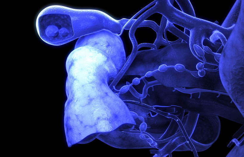 内脏,动脉,静脉,胆囊,无人,横图,插画,室内,特写,白天,正面,数码,科技,静物,阴影,黑色背景,网络,医学,光芒,高光,几何,计算机图形,合成,图画,画,模型,人体,电脑合成图,数码合成图,生物学,器官,漫画,生理学,写实,具体,具象,胆囊结石,彩图