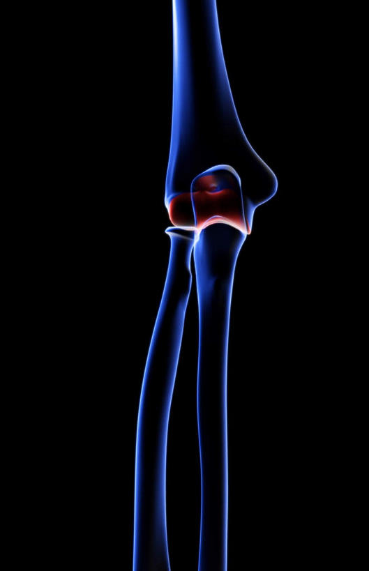 动脉,静脉,骨骼,无人,医院,竖图,插画,室内,特写,白天,正面,数码,科技,静物,阴影,局部,辐射,科学,网络,医学,骨头,高光,几何,计算机图形,合成,图画,画,模型,人体,部分,电脑合成图,数码合成图,骨架,生物学,科学技术,x射线,x光,漫画,医疗机构,生理学,写实,具体,具象,手肘,内上髁,外侧髁,外上髁,半身,彩图,病院,诊所,电磁波,电磁辐射