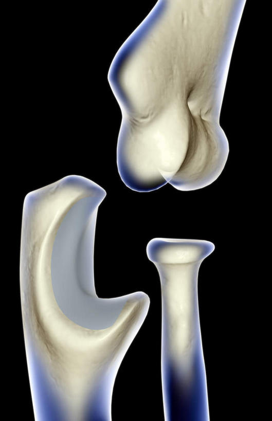 动脉,静脉,骨骼,无人,医院,竖图,插画,室内,特写,白天,正面,数码,科技,静物,阴影,局部,辐射,科学,网络,医学,骨头,高光,几何,计算机图形,合成,图画,画,模型,人体,部分,电脑合成图,数码合成图,骨架,生物学,科学技术,x射线,x光,漫画,医疗机构,生理学,写实,具体,具象,手肘,肱骨,内上髁,半身,彩图,病院,诊所,电磁波,电磁辐射