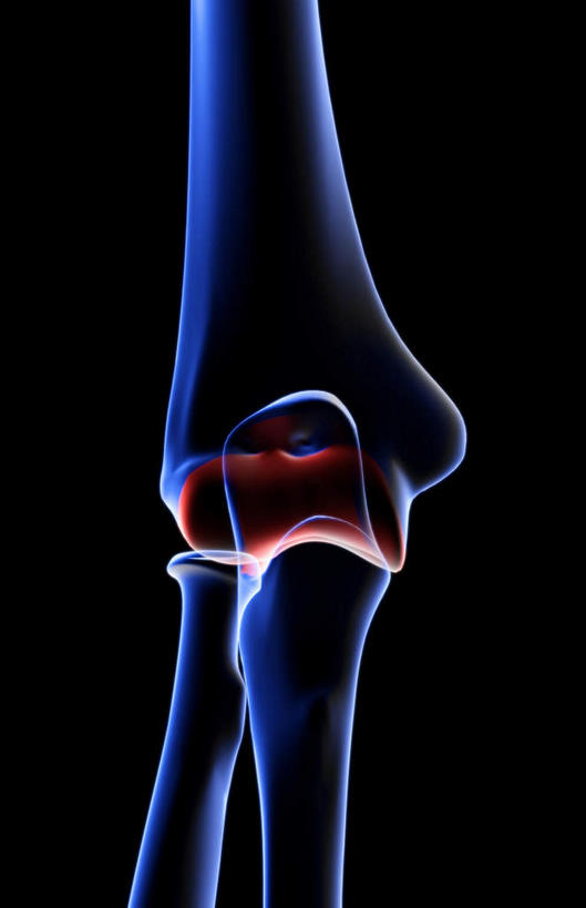 动脉,静脉,骨骼,无人,医院,竖图,插画,室内,特写,白天,正面,数码,科技,静物,阴影,局部,辐射,科学,网络,医学,骨头,高光,几何,计算机图形,合成,图画,画,模型,人体,部分,电脑合成图,数码合成图,骨架,生物学,科学技术,x射线,x光,漫画,医疗机构,生理学,写实,具体,具象,手肘,内上髁,外侧髁,外上髁,半身,彩图,病院,诊所,电磁波,电磁辐射