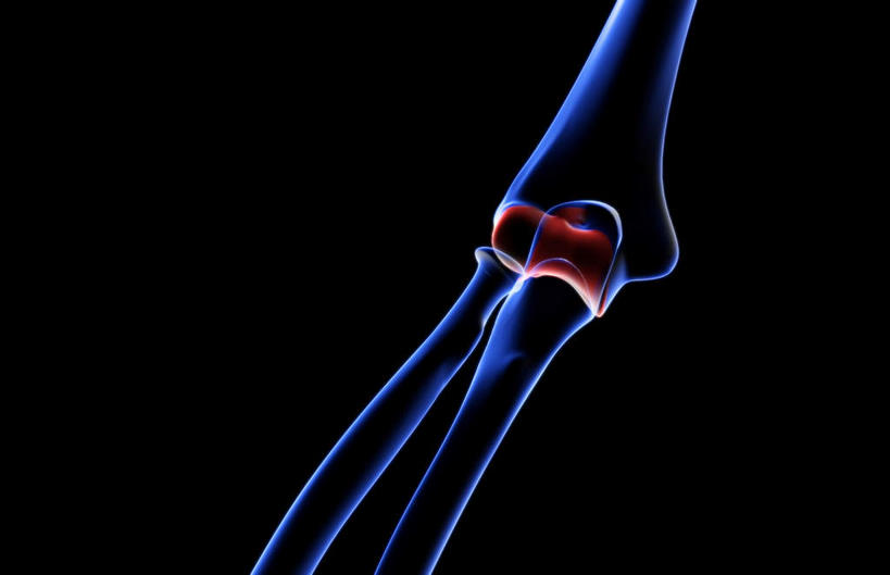 动脉,静脉,骨骼,无人,医院,竖图,插画,室内,特写,白天,正面,数码,科技,静物,阴影,局部,辐射,科学,网络,医学,骨头,高光,几何,计算机图形,合成,图画,画,模型,人体,部分,电脑合成图,数码合成图,骨架,生物学,科学技术,x射线,x光,漫画,医疗机构,生理学,写实,具体,具象,手肘,内上髁,外侧髁,外上髁,半身,彩图,病院,诊所,电磁波,电磁辐射