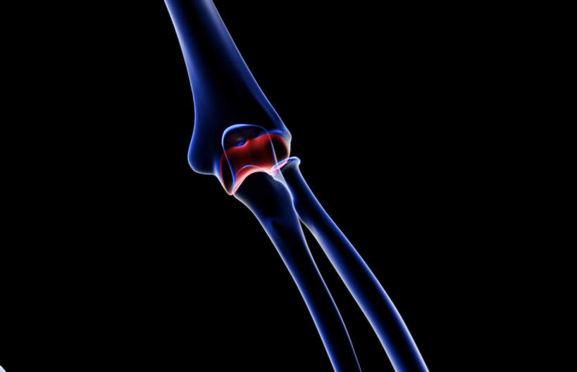 动脉,静脉,骨骼,无人,医院,竖图,插画,室内,特写,白天,正面,数码,科技,静物,阴影,局部,辐射,科学,网络,医学,骨头,高光,几何,计算机图形,合成,图画,画,模型,人体,部分,电脑合成图,数码合成图,骨架,生物学,科学技术,x射线,x光,漫画,医疗机构,生理学,写实,具体,具象,手肘,内上髁,外侧髁,外上髁,半身,彩图,病院,诊所,电磁波,电磁辐射