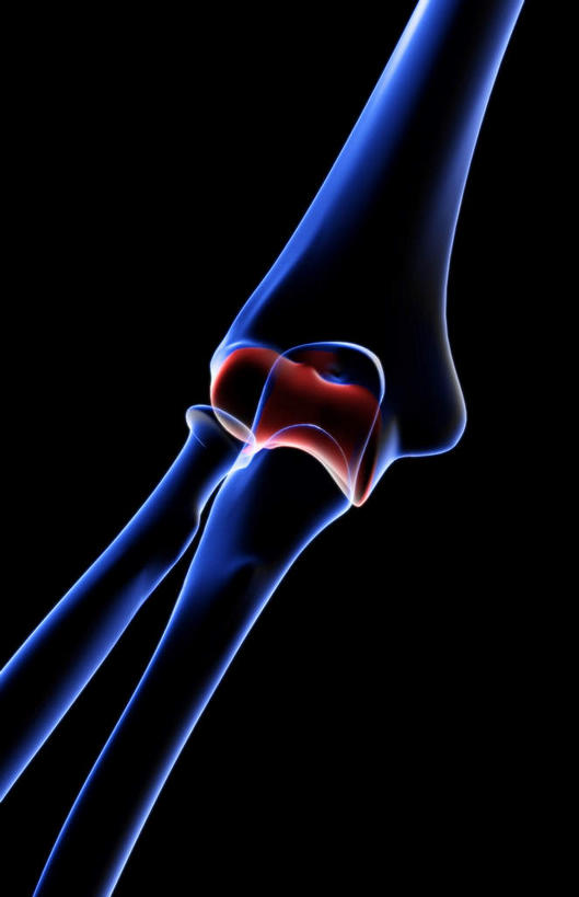 动脉,静脉,骨骼,无人,医院,竖图,插画,室内,特写,白天,正面,数码,科技,静物,阴影,局部,辐射,科学,网络,医学,骨头,高光,几何,计算机图形,合成,图画,画,模型,人体,部分,电脑合成图,数码合成图,骨架,生物学,科学技术,x射线,x光,漫画,医疗机构,生理学,写实,具体,具象,手肘,内上髁,外侧髁,外上髁,半身,彩图,病院,诊所,电磁波,电磁辐射