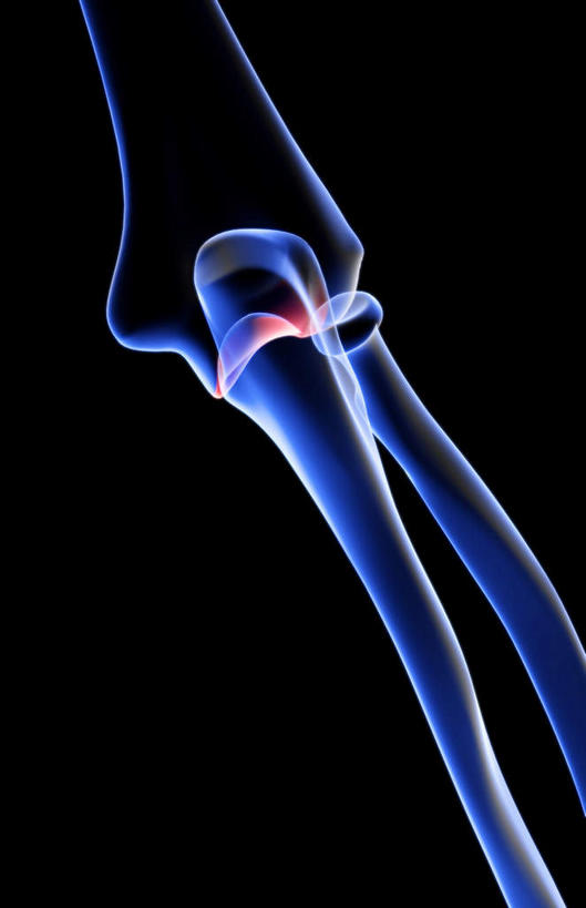 动脉,静脉,骨骼,无人,医院,竖图,插画,室内,特写,白天,正面,数码,科技,静物,阴影,局部,辐射,科学,网络,医学,骨头,高光,几何,计算机图形,合成,图画,画,模型,人体,部分,电脑合成图,数码合成图,骨架,生物学,科学技术,x射线,x光,漫画,医疗机构,生理学,写实,具体,具象,手肘,内上髁,外侧髁,外上髁,半身,彩图,病院,诊所,电磁波,电磁辐射