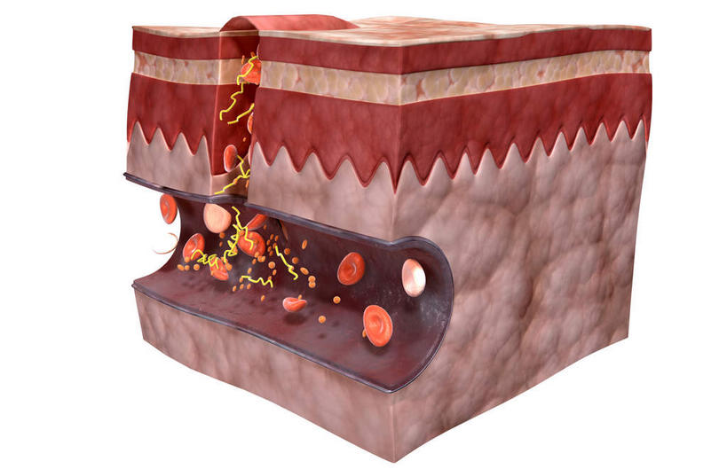 无人,横图,插画,室内,特写,白天,正面,数码,科技,静物,阴影,网络,医学,细胞,高光,几何,计算机图形,合成,图画,画,人体,皮肤,电脑合成图,数码合成图,生物学,血细胞,血小板,漫画,生理学,写实,具体,具象,血块,纤维蛋白,彩图