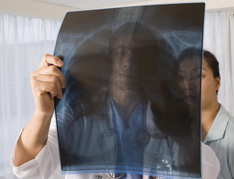 东方人,两个人,医生,站,横图,x光片,室内,白天,正面,衬衫,窗帘,亚洲,阴影,检查,辐射,光线,科学,医学,影子,领带,注视,黄种人,听诊器,观察,看,站着,医护人员,医疗人员,家属,观看,察看,医疗,医疗设备,科学技术,x射线,关注,x光,男人,男性,年轻男性,年轻女性,女人,女性,亚洲人,大夫,站立,半身,彩图,衬衣,电磁波,电磁辐射