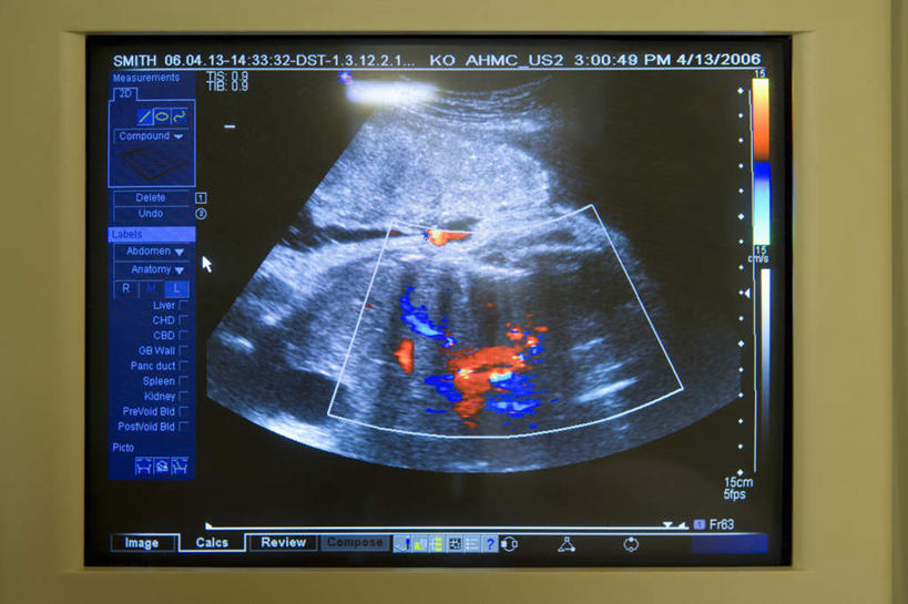 无人,横图,照片,室内,特写,白天,正面,显示器,静物,阴影,检查,反射,医学,屏幕,影子,显示屏,摄影,生长,成长,检测,胎儿,发育,B超,红外线,孕育,输出设备,相片,彩图,拍摄,照相,胚胎