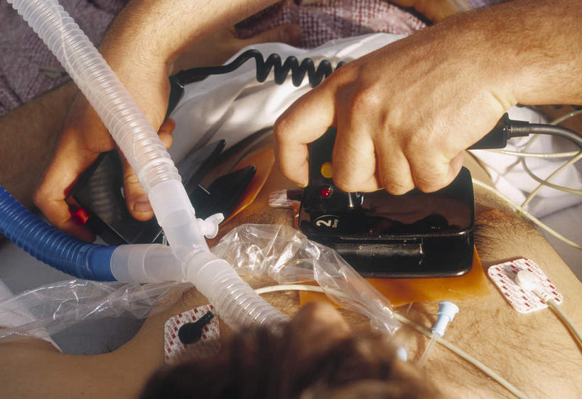 西方人,脸,头,脸颊,手,两个人,医生,病人,医院,躺,横图,俯视,室内,特写,白天,欧洲,欧洲人,双手,握,朦胧,模糊,拿,拿着,肩膀,医护人员,医疗人员,手部,氧气瓶,握着,医疗,医疗设备,氧气面罩,电子设备,病患,医疗器械,医疗工具,医疗机构,除颤器,电复律机,心脏除颤器,卧着,男人,男性,中年男性,白种人,头部,脸部,脸蛋,面部,大夫,患者,就医者,躺着,卧,半身,彩图,高角度拍摄,病院,诊所