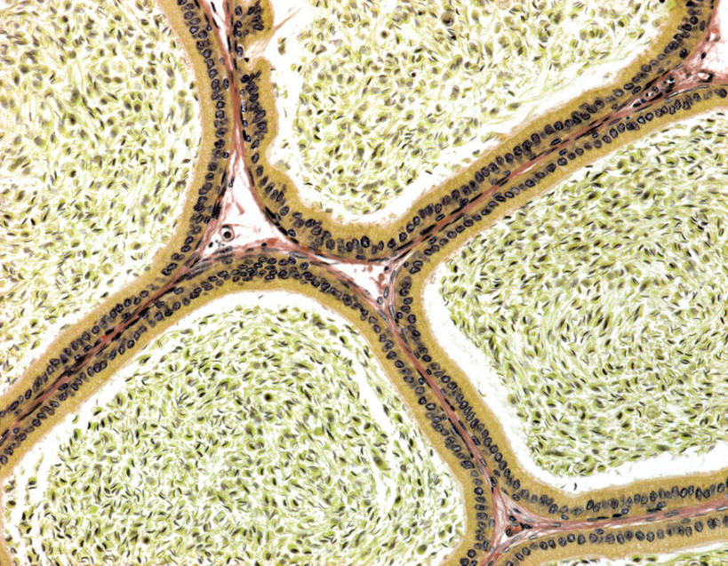 膀胱,睾丸,阴囊,尿道,无人,横图,俯视,室内,特写,白天,仪器,许多,检查,反射,分析,科学,显微镜,很多,排列,精子,观察,清晰,探索,四块,人体,摄影,放大,观看,仔细,透镜,组织,凸透镜,聚焦,繁殖,关注,泌尿系统,前列腺,光学,清楚,附睾,摆列,内生殖器,排泄器官,外生殖器,输精管,平滑肌,精囊腺,尿道球腺,射精管,肾小管,男性,彩图,高角度拍摄,拍摄,布列,分列,男性生殖系统,上皮组织,生殖器官,蕃殖,繁生,孳生,滋生