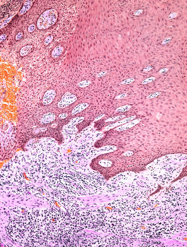 无人,竖图,俯视,室内,白天,仪器,微生物,检查,反射,分析,科学,医学,细胞,显微镜,观察,清晰,探索,摄影,放大,观看,仔细,透镜,生物学,血浆,凸透镜,聚焦,关注,痛,疼,光学,清楚,炎症,上皮细胞,彩图,高角度拍摄,拍摄,牙龈炎,上皮组织