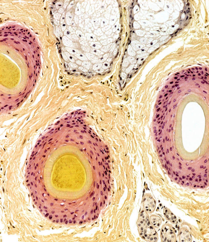 动脉,静脉,无人,竖图,俯视,室内,特写,白天,仪器,五个,许多,盘绕,检查,环绕,围绕,反射,分析,科学,显微镜,圈,环抱,排列,黄色,红色,白色,模型,观察,清晰,探索,摄影,缭绕,放大,观看,仔细,透镜,人体器官,凸透镜,聚焦,器官,关注,光学,清楚,毛囊,摆列,皮脂腺,彩图,高角度拍摄,拍摄,布列,分列