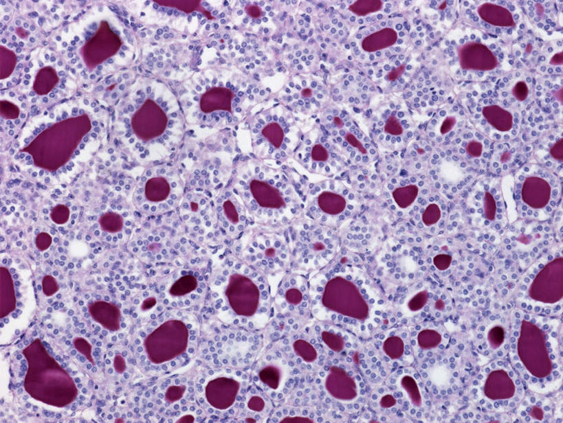 无人,横图,俯视,室内,特写,白天,仪器,微生物,许多,连接,盘绕,组合,检查,朦胧,模糊,环绕,围绕,反射,分析,科学,医学,细胞,显微镜,圈,很多,环抱,旋转,排列,紫色,观察,清晰,探索,摄影,缭绕,放大,观看,仔细,链接,透镜,生物学,凸透镜,紧固,聚焦,关注,拼接,拼凑,扭转,光学,拼合,凑集,聚合,撮合,链结,牢固,清楚,甲状腺,解剖学,摆列,杯状细胞,上皮细胞,彩图,高角度拍摄,拍摄,布列,分列