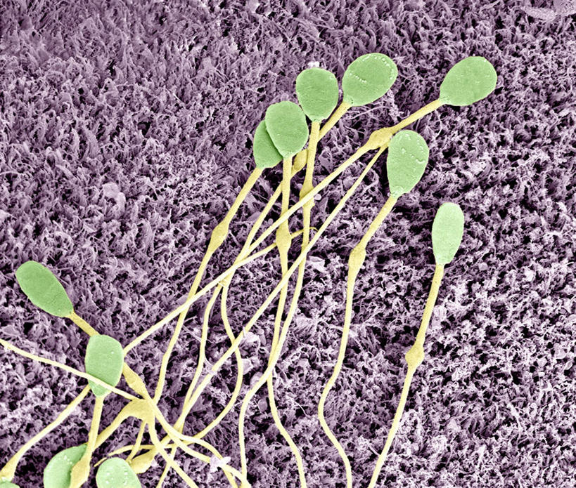 膀胱,睾丸,阴囊,尿道,无人,横图,插画,室内,特写,白天,正面,数码,科技,阴影,网络,高光,几何,计算机图形,合成,图画,画,精子,电脑合成图,数码合成图,漫画,泌尿系统,前列腺,写实,具体,具象,附睾,内生殖器,排泄器官,外生殖器,输精管,精囊腺,尿道球腺,射精管,彩图,男性生殖系统,生殖器官