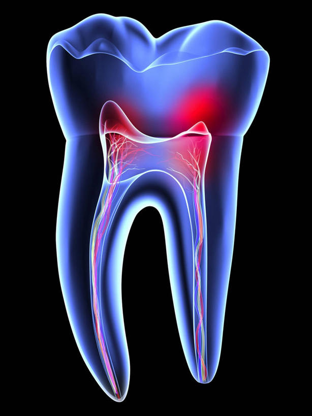 牙齿,无人,竖图,插画,x光片,室内,白天,正面,数码,科技,阴影,黑色背景,亮光,透明,辐射,科学,网络,医学,光亮,高光,几何,计算机图形,合成,图画,画,一个,红色,蓝色,单个,电脑合成图,数码合成图,医疗,科学技术,x射线,合成图,痛,疼,x光,漫画,写实,具体,具象,通明,齿,牙,牙龈,彩图,电磁波,电磁辐射