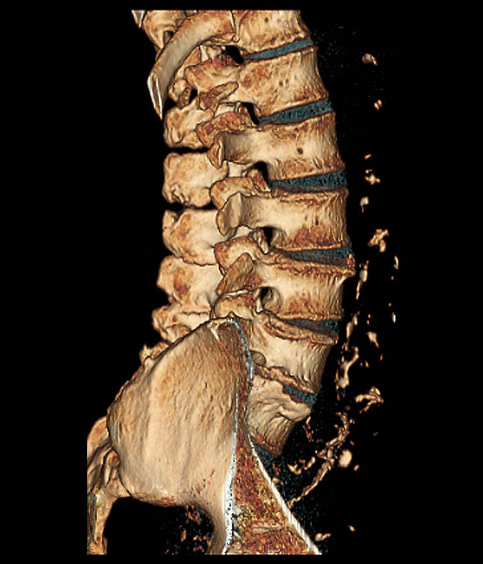 脊髓,骨骼,无人,竖图,x光片,室内,特写,白天,白色背景,正面,机器,辐射,医学,骨头,破坏,设备,破损,摄影,影棚,损坏,骨架,医疗,医疗设备,疾病,x射线,医疗器械,x光,医疗工具,CAT扫描仪,检测工具,脊柱,彩图,影棚拍摄,拍摄,计算机X射线轴向分层造影扫描仪,计算机轴向断层扫描,电磁波,电磁辐射