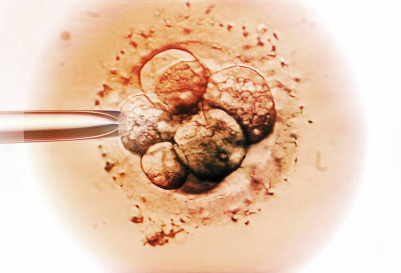 无人,横图,室内,特写,白天,白色背景,正面,实验,仪器,科技,微生物,静物,检查,研究,透明,反射,分析,科学,化学,医学,测试,滴管,细胞,显微镜,玻璃制品,观察,怀孕,器皿,清晰,探索,摄影,影棚,放大,观看,仔细,透镜,医疗,生物学,科学技术,凸透镜,聚焦,关注,人工受精,计量,试管婴儿,玻璃仪器,试验耗材,实验用品,吸液管,光学,清楚,移液管,显微图片,彩图,影棚拍摄,拍摄,体外受精,体外受孕