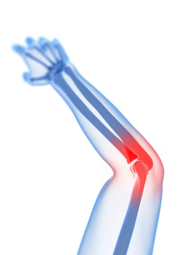 手,骨骼,关节,一个人,无人,举,竖图,插画,室内,特写,白天,白色背景,正面,数码,科技,仅一个男性,仅一个人,阴影,网络,骨头,高光,几何,计算机图形,合成,图画,画,仅一个年轻男性,红色,蓝色,托,疼痛,手部,单手,电脑合成图,数码合成图,骨架,疾病,合成图,漫画,写实,具体,具象,炎症,关节炎,男人,男性,年轻男性,举起,举手,举着,向上举,向上伸,向上托,半身,彩图,发炎