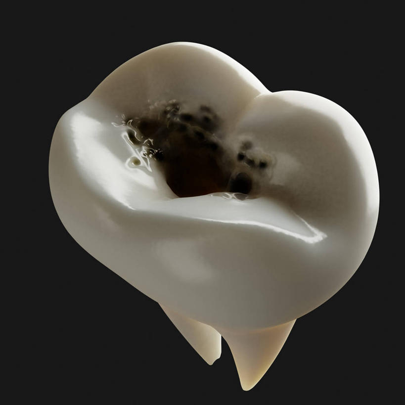 牙齿,无人,方图,插画,室内,特写,白天,正面,数码,科技,阴影,黑色背景,网络,高光,几何,计算机图形,合成,图画,画,一个,单个,腐烂,电脑合成图,数码合成图,蛀牙,合成图,漫画,写实,具体,具象,腐败,腐臭,腐朽,齿,牙,牙龈,彩图