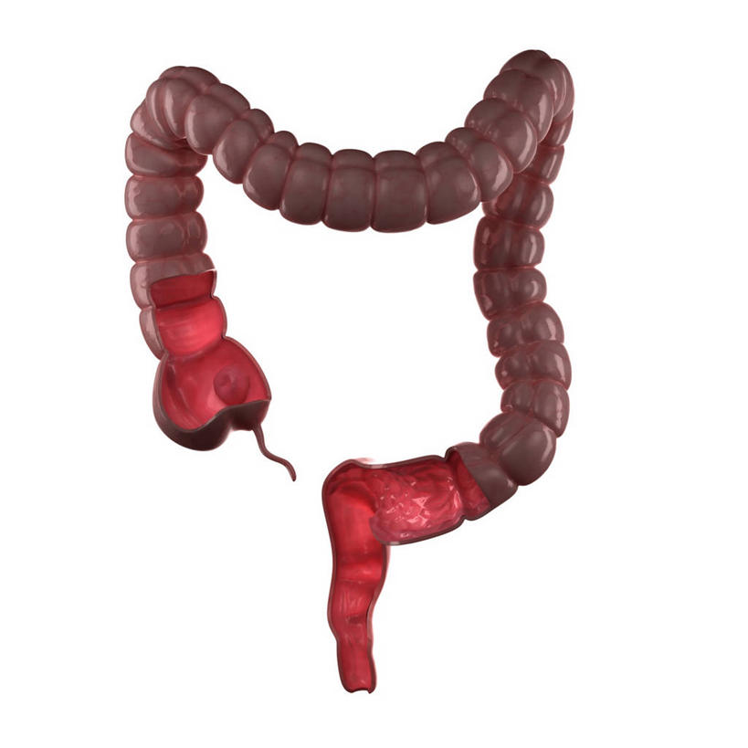 内脏,肠,动脉,静脉,无人,方图,插画,室内,白天,白色背景,正面,数码,科技,阴影,科学,网络,医学,高光,几何,计算机图形,合成,图画,画,粉色,红色,人体,电脑合成图,数码合成图,生物学,人体器官,器官,合成图,漫画,剖面,切面,写实,具体,具象,自然科学,博物学,生物科学,大肠,彩图,剖视图,剖切面,剖视