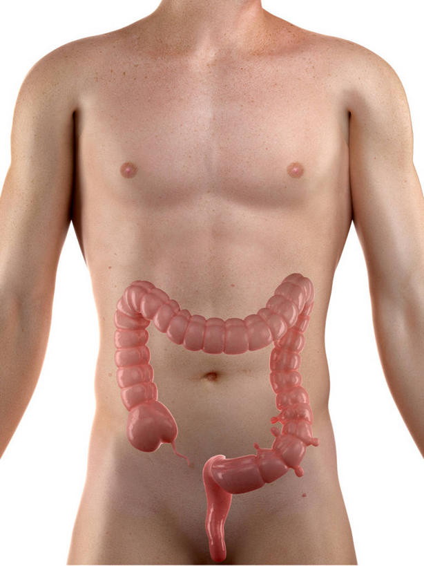 内脏,肠,动脉,静脉,一个人,无人,站,竖图,插画,室内,白天,白色背景,正面,数码,科技,仅一个男性,仅一个人,阴影,突起,科学,网络,医学,高光,几何,计算机图形,合成,图画,裸露,画,仅一个年轻男性,站着,人体,赤裸,电脑合成图,数码合成图,疾病,生物学,人体器官,器官,合成图,裸,漫画,写实,具体,具象,隆起,自然科学,博物学,生物科学,男人,男性,年轻男性,大肠,站立,半身,彩图,囊袋,囊状突起,憩室,憩室病