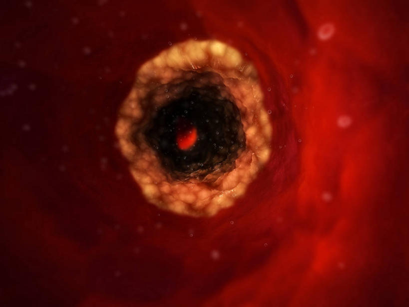 血管,毛细血管,无人,横图,插画,室内,白天,正面,兴奋,热情,数码,科技,微生物,许多,阴影,科学,网络,红血球,医学,洞,高光,几何,计算机图形,开放,合成,图画,画,红色,白色,健康,温暖,奔放,活力,积极,激情,洞穴,朝气,暖色,吉祥,电脑合成图,数码合成图,生物学,血细胞,生命,合成图,漫画,饱满,白细胞,穴,写实,具体,具象,革命,红细胞,热烈,赤色,充实,斗志,喜气,主动,彩图,欢乐