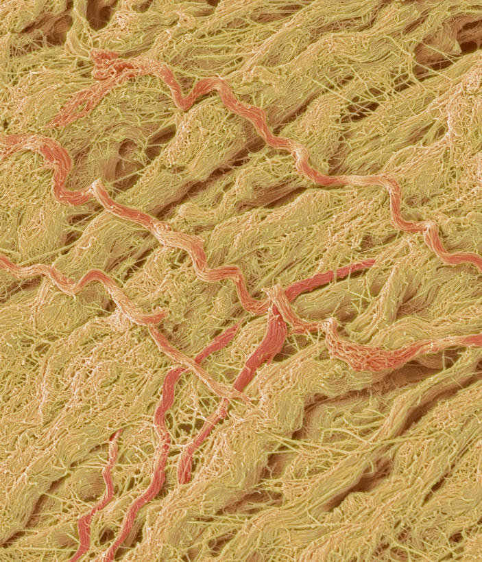 无人,竖图,室内,特写,白天,正面,仪器,微生物,检查,透明,反射,分析,科学,医学,细胞,显微镜,辉煌,黄色,观察,健康,清晰,探索,活泼,放大,观看,希望,仔细,暖色,纤维,透镜,生物学,凸透镜,聚焦,关注,光辉,光学,清楚,光明,结缔组织,功名,轻快,显微图片,自然科学,博物学,生物科学,彩图,组织细胞,扫描电镜,扫描电子显微镜,基本组织,基质,细胞外间质