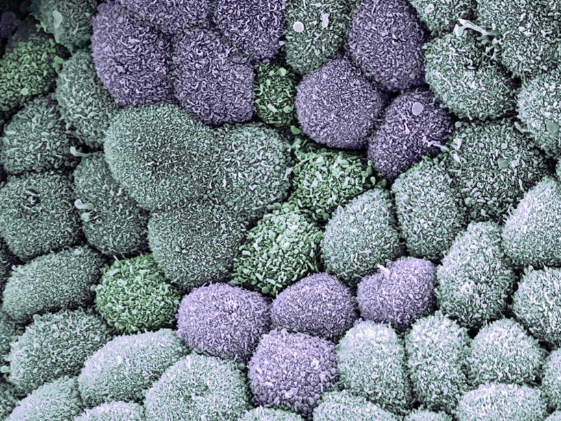 内脏,胰腺,动脉,静脉,胆囊,无人,横图,插画,室内,白天,正面,数码,科技,静物,阴影,网络,医学,绒毛,高光,几何,计算机图形,合成,图画,画,粘液,人体,电脑合成图,数码合成图,生物学,人体器官,器官,黏液,漫画,生理学,写实,具体,具象,胆管,胰管,纤毛,彩图