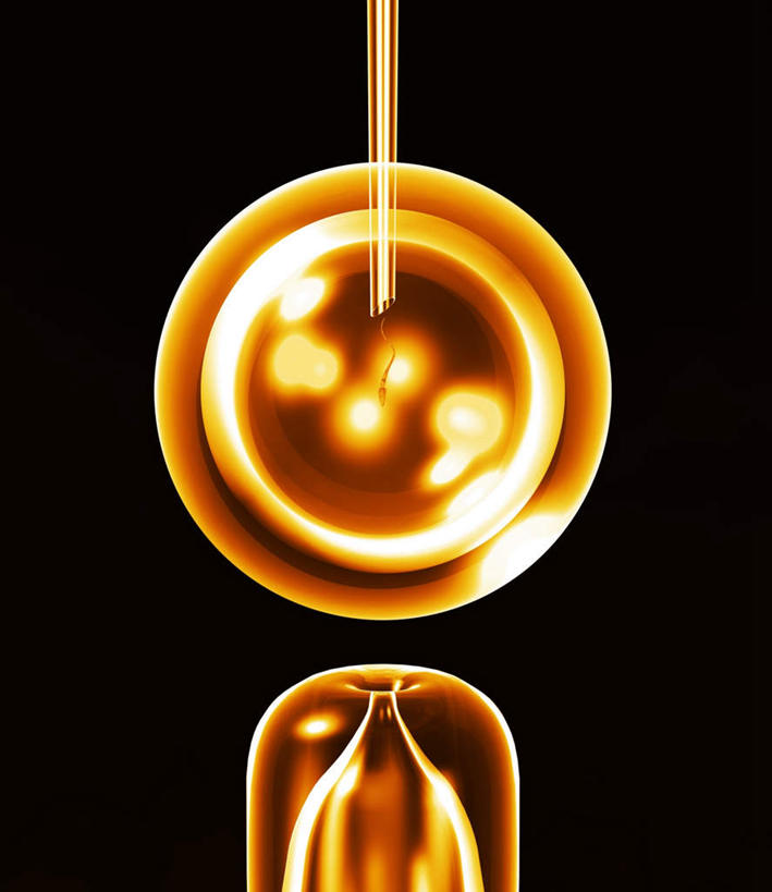 无人,竖图,插画,室内,白天,正面,数码,科技,盘绕,阴影,黑色背景,环绕,围绕,光线,光泽,科学,网络,医学,光芒,高光,几何,计算机图形,合成,图画,环抱,画,精子,怀孕,缭绕,电脑合成图,数码合成图,医疗,科学技术,进入,人工受精,卵子,漫画,光辉,试管婴儿,写实,具体,具象,毫光,彩图,体外受精,体外受孕