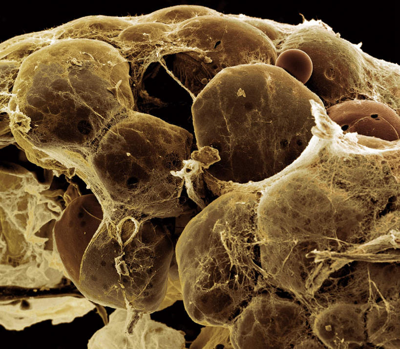 无人,横图,室内,白天,正面,数码,科技,一排,许多,阴影,黑色背景,网状,整齐,网络,医学,细胞,褐色,很多,高光,几何,计算机图形,构造,合成,排列,脂肪,生物,堆,电脑合成图,数码合成图,医疗,组织,生物学,队列,生理学,写实,具体,具象,彩图