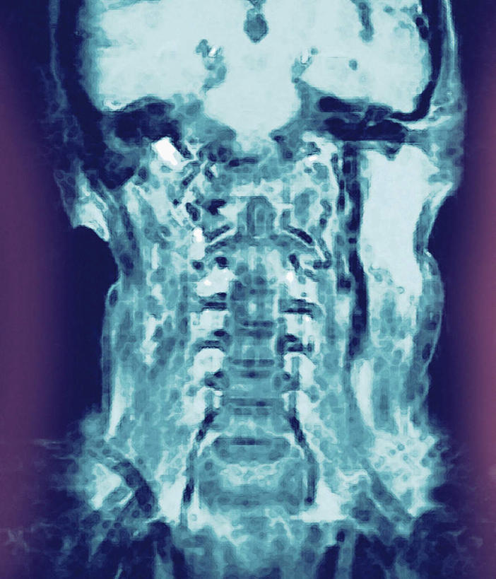 脖子,骨骼,无人,竖图,插画,室内,白天,正面,机器,数码,科技,阴影,网络,医学,骨头,高光,几何,计算机图形,合成,图画,设备,画,电脑合成图,数码合成图,骨架,医疗,核磁共振,漫画,核磁共振成像,写实,具体,具象,磁共振成像,核磁共振技术,脖,颈,颈部,彩图