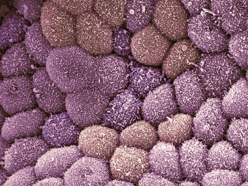 无人,横图,插画,室内,白天,正面,数码,科技,静物,一堆,许多,阴影,堆叠,堆积,网络,医学,圆形,绒毛,细胞,圆,很多,高光,几何,计算机图形,合成,图画,画,紫色,人体,摄影,堆,电脑合成图,数码合成图,生物学,漫画,生理学,写实,具体,具象,胆,上皮细胞,彩图,拍摄