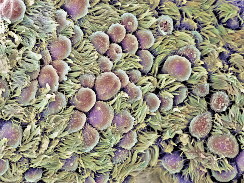 子宫,无人,横图,插画,室内,白天,正面,数码,实验,科技,静物,一堆,许多,阴影,堆叠,堆积,研究,科学,网络,医学,很多,高光,几何,计算机图形,合成,图画,画,排列,红色,绿色,人体,摄影,堆,电脑合成图,数码合成图,科研,生物学,器官,化验,检验,漫画,输卵管,生理学,写实,具体,具象,纤毛,摆列,微绒毛,染色,彩图,拍摄,布列,分列,生殖器官