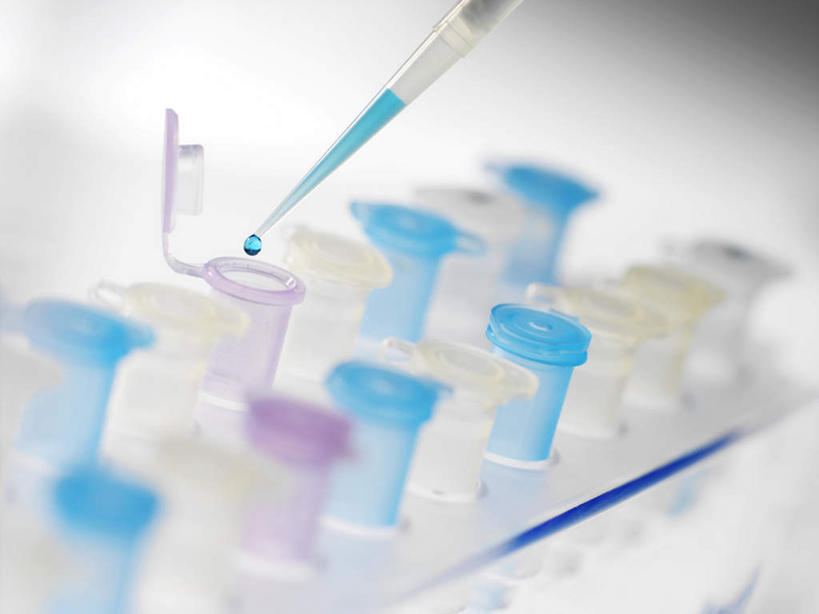 无人,横图,俯视,室内,特写,白天,白色背景,实验,仪器,静物,研究,分析,化学,测试,液体,蓝色,吸管,器皿,生物,摄影,影棚,试验耗材,实验用品,化学器材,彩图,高角度拍摄,影棚拍摄,拍摄,移液器