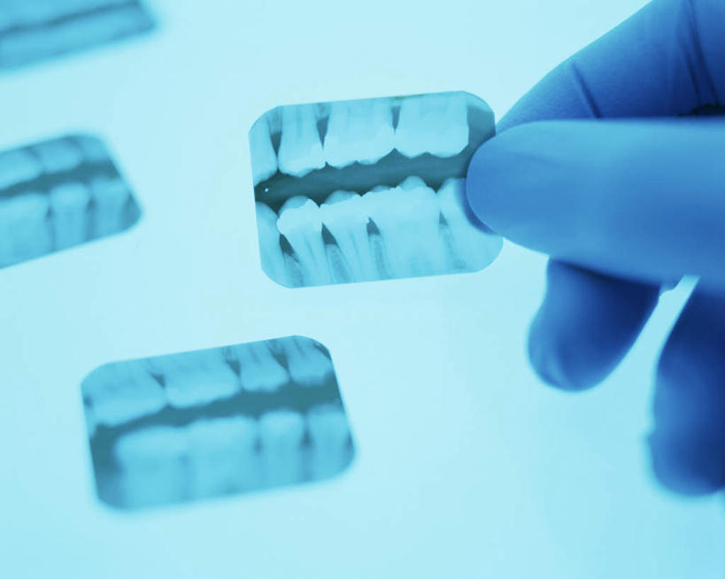 西方人,手,牙齿,一个人,横图,x光片,室内,特写,白天,正面,科技,欧洲,欧洲人,仅一个男性,仅一个人,仅一个中年男性,握,阴影,辐射,光线,科学,医学,影子,灯光,拿,拿着,三个,拍照,手部,探索,握着,保健,创意,摄影,发现,医疗,科学技术,x射线,探讨,x光,创新,新意,探究,探求,男人,男性,中年男性,白种人,齿,牙,牙龈,半身,彩图,电磁波,电磁辐射