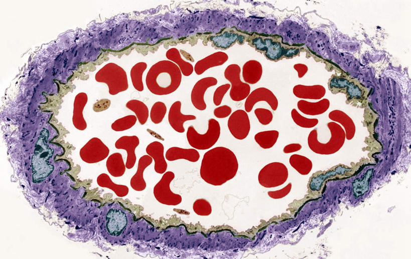 血管,无人,横图,室内,特写,白天,白色背景,正面,仪器,科技,静物,一堆,堆叠,堆积,检查,反射,分离,分析,科学,红血球,医学,细胞,显微镜,扩散,红色,观察,血液,清晰,探索,人体,创意,放大,观看,堆,发现,仔细,分散,透镜,生物学,血细胞,凸透镜,聚焦,关注,探讨,创新,生理学,光学,清楚,新意,红细胞,内膜,中膜,上皮细胞,探究,涣散,疏散,探求,彩图