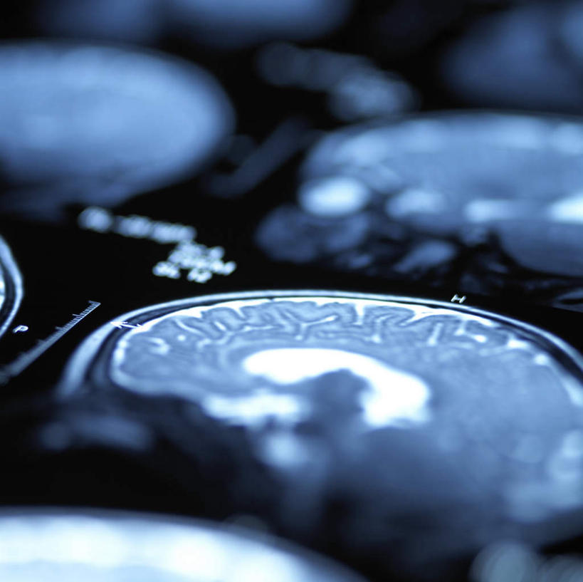 无人,方图,俯视,x光片,室内,特写,白天,机器,静物,辐射,科学,医学,设备,摄影,影棚,医疗,科学技术,x射线,x光,核磁共振,核磁共振成像,磁共振成像,核磁共振技术,中枢神经系统,彩图,高角度拍摄,影棚拍摄,拍摄,神经系统,电磁波,电磁辐射