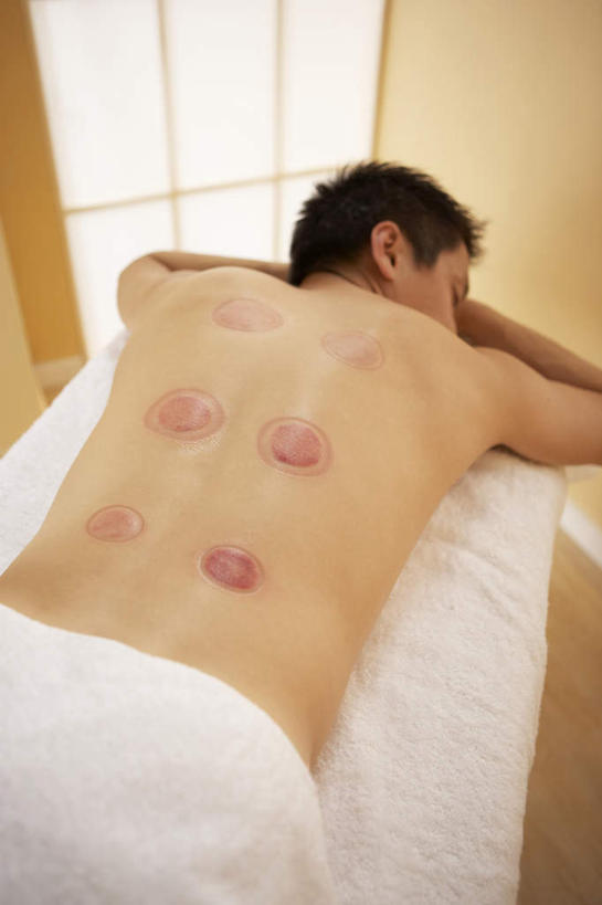 西方人,一个人,闭眼,竖图,俯视,室内,白天,窗户,欧洲,欧洲人,仅一个男性,仅一个人,阴影,光线,医学,影子,痕迹,文化,裸露,玻璃窗,仅一个年轻男性,紫色,阳光,趴着,治疗,保健,医疗,中国文化,裸,拔火罐,中医,火罐,医治,陈迹,拔罐,拔罐疗法,拔罐子,火罐疗法,中医学,男人,男性,年轻男性,白种人,闭眼睛,闭着眼,闭着眼睛,趴,半身,彩图,高角度拍摄,传统文化