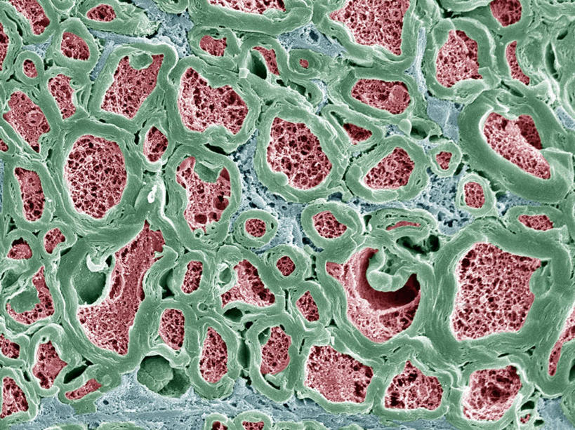 无人,横图,插画,室内,特写,白天,正面,数码,科技,静物,阴影,网络,细胞核,血球,医学,细胞,高光,几何,计算机图形,合成,图画,画,蓝色,人体,电脑合成图,数码合成图,生物学,血细胞,横截面,漫画,生理学,写实,具体,具象,神经细胞,中枢神经系统,彩图