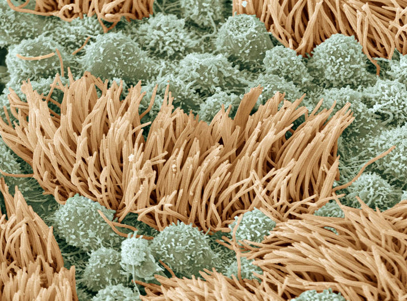 内脏,动脉,静脉,无人,横图,室内,特写,白天,正面,数码,科技,静物,阴影,网络,医学,高光,几何,计算机图形,合成,模型,人体,电脑合成图,数码合成图,生物学,人体器官,器官,输卵管,生理学,写实,具体,具象,上皮细胞,彩图,生殖器官