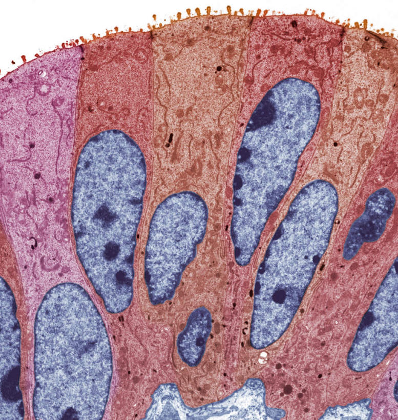 内脏,动脉,静脉,无人,竖图,室内,特写,白天,白色背景,正面,数码,科技,静物,阴影,网络,医学,高光,几何,计算机图形,合成,模型,人体,电脑合成图,数码合成图,生物学,人体器官,器官,输卵管,生理学,写实,具体,具象,上皮细胞,彩图,生殖器官