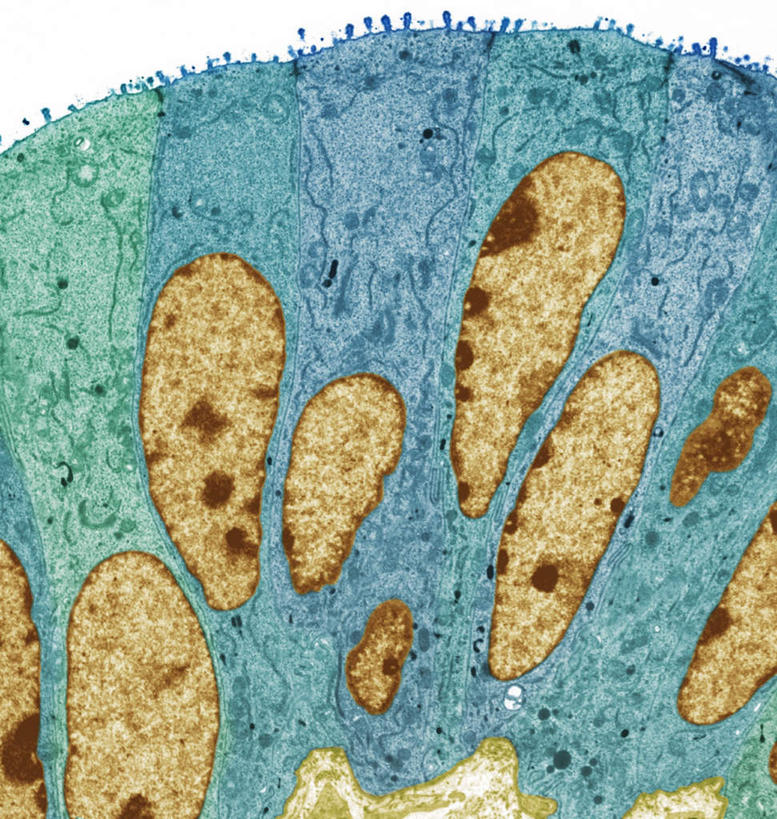 内脏,动脉,静脉,无人,竖图,室内,特写,白天,白色背景,正面,数码,科技,静物,阴影,网络,医学,高光,几何,计算机图形,合成,模型,人体,电脑合成图,数码合成图,生物学,人体器官,器官,输卵管,生理学,写实,具体,具象,上皮细胞,彩图,生殖器官