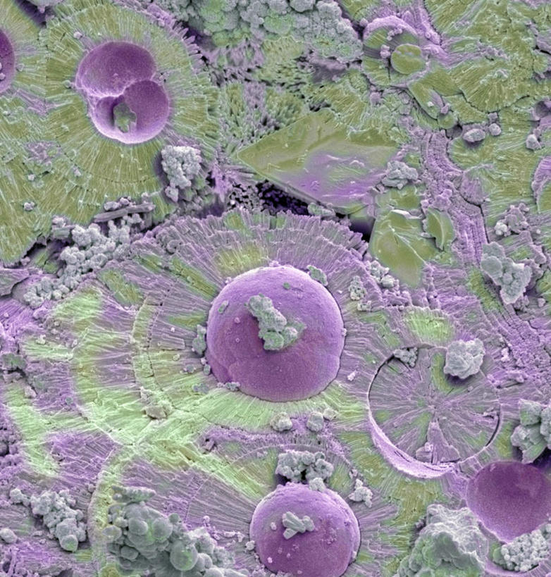 膀胱,无人,竖图,室内,特写,白天,白色背景,正面,数码,科技,静物,阴影,网络,医学,细胞,高光,几何,计算机图形,合成,人体,电脑合成图,数码合成图,生物学,泌尿系统,生理学,写实,具体,具象,彩图