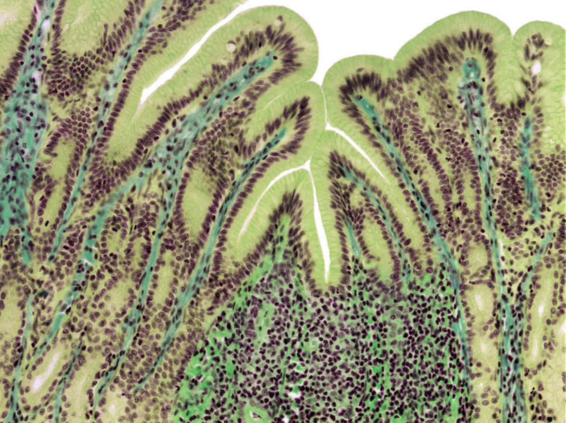 无人,横图,插画,室内,特写,白天,白色背景,正面,数码,科技,阴影,网络,高光,几何,计算机图形,合成,图画,画,电脑合成图,数码合成图,漫画,写实,具体,具象,淋巴系统,淋巴细胞,胃壁,淋巴,淋巴管,淋巴液,淋巴组织,免疫系统,免疫组织,彩图