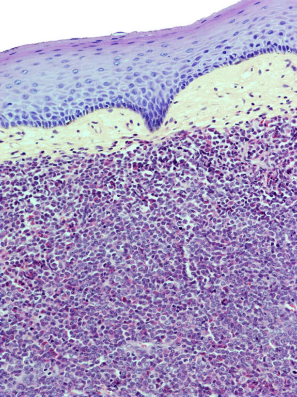 无人,竖图,插画,室内,特写,白天,正面,数码,科技,阴影,网络,高光,几何,计算机图形,合成,图画,画,电脑合成图,数码合成图,漫画,写实,具体,具象,淋巴结,淋巴系统,淋巴细胞,淋巴,淋巴管,淋巴液,淋巴组织,免疫系统,免疫组织,彩图