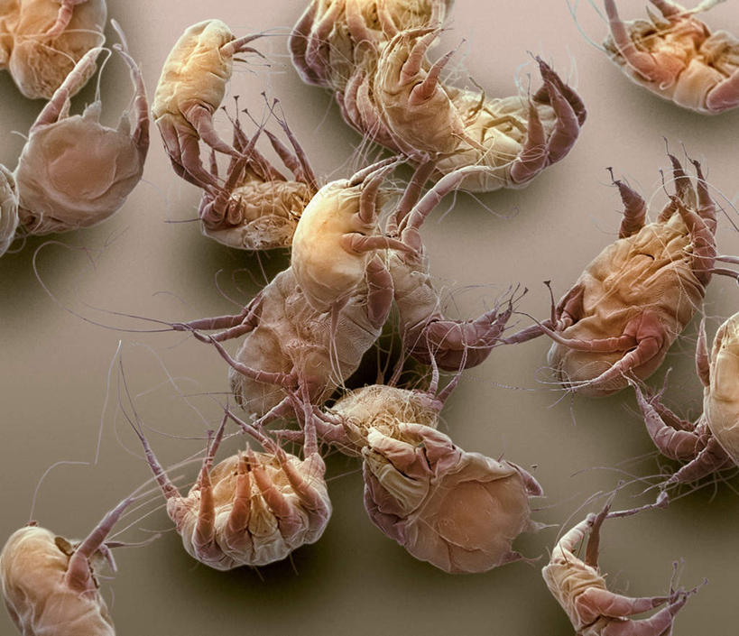 无人,横图,俯视,室内,白天,仪器,许多,检查,散落,反射,分析,科学,显微镜,红色,动物,观察,清晰,探索,放大,观看,仔细,透镜,凸透镜,聚焦,关注,光学,清楚,寄生,寄生虫,螨虫,扁形动物,彩图,高角度拍摄