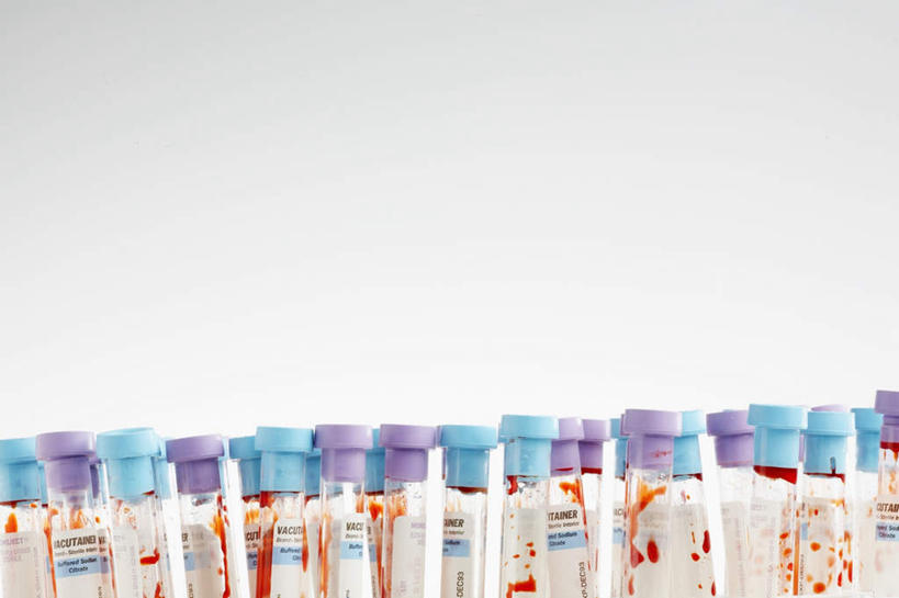 无人,横图,俯视,室内,特写,白天,白色背景,实验,一排,许多,研究,整齐,分析,化学,测试,试管,试管架,架子,排列,蓝色,紫色,摄影,影棚,队列,试验耗材,实验用品,彩图,高角度拍摄,影棚拍摄,拍摄