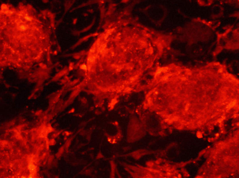 无人,横图,俯视,室内,特写,白天,实验,仪器,微生物,静物,黑色背景,检查,研究,反射,分析,科学,医学,细胞,显微镜,红色,观察,清晰,探索,人体,放大,观看,仔细,透镜,荧光,科研,生物学,凸透镜,聚焦,关注,化验,检验,生理学,光学,清楚,彩图,高角度拍摄,干细胞