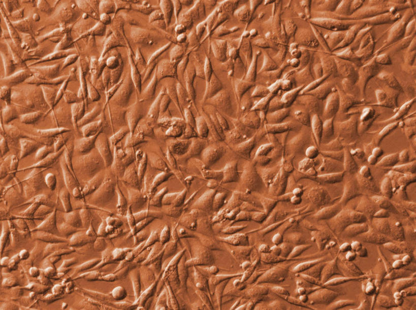 无人,横图,俯视,室内,特写,白天,实验,仪器,微生物,静物,检查,研究,反射,分析,科学,医学,细胞,显微镜,观察,清晰,探索,人体,放大,观看,仔细,透镜,科研,生物学,凸透镜,聚焦,关注,化验,检验,生理学,光学,清楚,彩图,高角度拍摄,黑色素瘤,黑素瘤