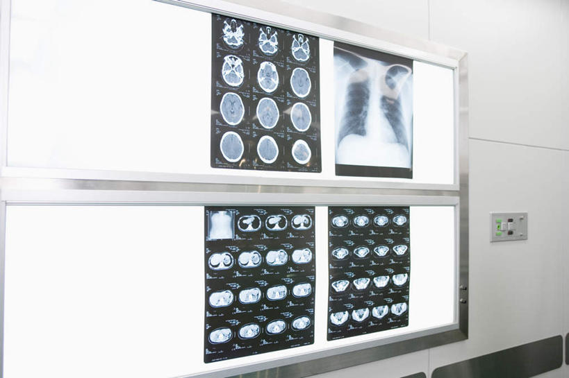 无人,医院,横图,x光片,室内,特写,白天,正面,静物,照明,一排,检查,整齐,辐射,科学,医学,墙,灯光,墙壁,墙面,灯,排列,灯具,观察,灯箱,照亮,医疗,医疗设备,科学技术,x射线,照明设备,队列,医疗器械,x光,医疗机构,看片灯箱,彩图,病院,诊所,电磁波,电磁辐射